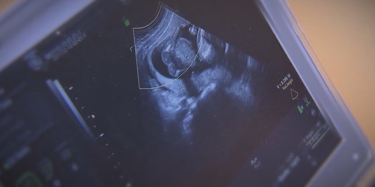 SD Abortion Rights: Fight over Amendment G continues SD Abortion Rights: Fight over Amendment G continues