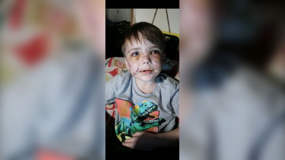 Conner's mother is grateful her son is alive, saying the hospital staff credited the neighbor...