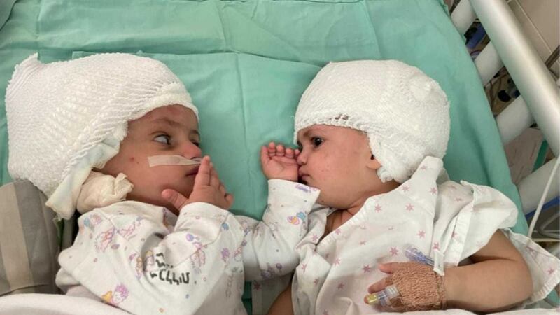 The 1-year-old twins, whose names were not released, are expected to make a full recovery from...